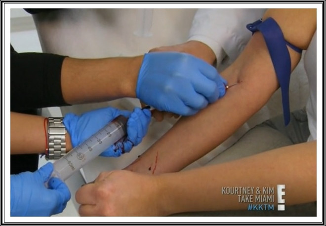 Első lépés: vérvétel