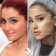 Mint a fotón is látszik, Ariana Grande sem tudott megállni egy után, szemöldökét megemeltette, az orrát is megcsináltatta és a szemeit is "kihúzatta". A rengeteg botox sem kérdéses, bár ha már ilyen fiatalon ehhez folyamodik, mi lesz később?