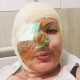 24 napig kómában feküdt, kevés esélyt adtak neki a túlélésre. Gyengén teljesített a szíve, a veséje és a tüdeje is, csodával határos módon ő azonban túlélte. Azóta pedig elfogadta sorsát, nem hibáztatja a nőt, aki a robbanásról tehet.