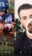 A kisfiú azután, hogy nagynénje az interneten részletezte a megható történetet, rengeteg bátorító kommentet és videóüzenetet kapott. Még Chris Evans, az Amerika kapitány is felkereste a családot, és elmondta Bridgernek, hogy egy igazi hős, akire húga és szülei is büszkék lehetnek.