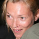 Kate Moss a mai napig egy igazi ikon, azonban ő sem tökéletes, ezt a mellékelt kép is bizonyítja. Róla már akkor is sokan azt állították, hogy egy antimodell, amikor fénykorát élte, így az őt kritizálóknak bizonyára most is markáns véleménye van.