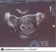 Baby on board - azaz "bébi a fedélzeten". Ezt a fotót az egykori tinisztár osztotta meg. Tízezrével érkeztek a like-ok, aztán váratlanul eltűnt a poszt.
