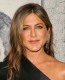 Az arcjóga előnyeiről számos sztár beszélt már az interjúi során: Jennifer Aniston, Meghan Markle és a Kardashian család tagjai is előszeretettel alkalmazzák ezt a módszert. Ezeknek a gyakorlatoknak az elvégzése tónusos és fiatalos megjelenést kölcsönöz az arcodnak, felemeli a megereszkedett és lelógó területeket, ezáltal pedig éveket letagadhatsz.