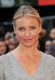 Cameron Diaz - rosacea

Cameron Diaz pirospozsgás arca nem a sminknek köszönhető, a színésznő ugyanis a rosacea néven ismert bőrproblémával küzd, mely kipirosodást és gyulladást idézhet elő az orron, az állon és az orcákon. Cameron Diaz már születése óta küzd ezzel a gyógyíthatatlan, de kezelhető betegséggel, több interjúban is beszélt már arról, milyen érzékeny a bőre.