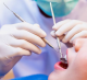 A szájüregi rák egy olyan daganatos betegség, amely a szájüregben és környékén megjelenő szövetszaporulatok összefoglaló elnevezése. A szájüregi rák többféle típusa létezik, amelyek különböző helyeken alakulhatnak ki, például az ajkakon, a nyelven, az orcák belfelületén, a szájfenéken vagy az ínyen.