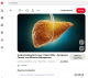 Az egyik legfontosabb tényező, amely a sovány embereknél is zsírmájhoz vezethet, az inzulinrezisztencia. Ilyenkor a sejtek nem reagálnak megfelelően az inzulinra, ezért a szervezet egyre több inzulint termel, hogy a vércukorszintet kordában tartsa. Ez a folyamat nem mindig jár látványos hízással, viszont jelentősen megterheli a májat. A máj ilyenkor fokozottan alakítja át a felesleges cukrot zsírrá, amely a májsejtekben rakódik le. Sok sovány ember úgy gondolja, hogy az inzulinrezisztencia kizárólag túlsúly esetén fordulhat elő, pedig genetikai hajlam, mozgáshiány vagy rendszertelen étkezés mellett normál testsúlynál is kialakulhat.