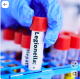 1. A láthatatlan ellenség a tüdőben - A Legionella pneumophila egy olyan természetes és épített vizes környezetben előforduló baktérium, amely az emberi szervezetbe jutva kifejezetten a légzőszerveket támadja meg. Nem emberről emberre terjed, és az emésztőrendszerbe jutva a gyomorsav elpusztítja, ám amint a tüdő léghólyagocskáiba kerül, súlyos gyulladásos reakciót vált ki. Különösen az idősekre, a dohányosokra és a legyengült immunrendszerűekre veszélyes, náluk magas lázat és életveszélyes szövődményeket okozhat. És a zuhany az egyik legveszélyesebb hely ilyen szempontból.