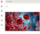 A leukémiás szemészeti eltérések között előfordulhatnak retinalis vérzések, éreredetű elváltozások, ideghártya-károsodások vagy a látóideg érintettsége. Ezek következménye lehet a hirtelen vagy fokozatosan jelentkező homályos látás, amely olykor még a vérképzőszervi betegség felismerése előtt megjelenhet először.