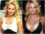 Pamela Anderson - A kebelcsoda korával egyenesen arányosan nőtt együtt a plasztikai sebészi beavatkozások száma. Mára már inkább elfordítjuk a fejünket, ha piros fürdőruhában elfutna a strandon. Pamela Anderson - A kebelcsoda korával egyenesen arányosan nőtt együtt a plasztikai sebészi beavatkozások száma. Mára már inkább elfordítjuk a fejünket, ha piros fürdőruhában elfutna a strandon.