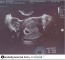 Baby on board - azaz "bébi a fedélzeten". Ezt a fotót az egykori tinisztár osztotta meg. Tízezrével érkeztek a like-ok, aztán váratlanul eltűnt a poszt.
Baby on board - azaz "bébi a fedélzeten". Ezt a fotót az egykori tinisztár osztotta meg. Tízezrével érkeztek a like-ok, aztán váratlanul eltűnt a poszt.
