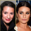 Lea Michele legalább három beavatkozással segített rá arca szépségére, a szemöldökét megemelték, orrplasztikát is csináltatott és rengeteg botoxot is igénybe vett.
Lea Michele legalább három beavatkozással segített rá arca szépségére, a szemöldökét megemelték, orrplasztikát is csináltatott és rengeteg botoxot is igénybe vett.