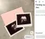 A törvényhozók igyekeznek egyensúlyt teremteni az anya önrendelkezési joga és a magzat védelme között. Ugyanakkor ez a szabályozás egy másik, kevésbé ismert jelenségre is reagál: a nemi alapon történő terhességmegszakítás megelőzésére.
A törvényhozók igyekeznek egyensúlyt teremteni az anya önrendelkezési joga és a magzat védelme között. Ugyanakkor ez a szabályozás egy másik, kevésbé ismert jelenségre is reagál: a nemi alapon történő terhességmegszakítás megelőzésére.