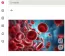 A leukémiás szemészeti eltérések között előfordulhatnak retinalis vérzések, éreredetű elváltozások, ideghártya-károsodások vagy a látóideg érintettsége. Ezek következménye lehet a hirtelen vagy fokozatosan jelentkező homályos látás, amely olykor még a vérképzőszervi betegség felismerése előtt megjelenhet először.
A leukémiás szemészeti eltérések között előfordulhatnak retinalis vérzések, éreredetű elváltozások, ideghártya-károsodások vagy a látóideg érintettsége. Ezek következménye lehet a hirtelen vagy fokozatosan jelentkező homályos látás, amely olykor még a vérképzőszervi betegség felismerése előtt megjelenhet először.
