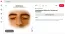 Bár a xanthelasma összefügghet a magas koleszterinszinttel, önmagában még nem bizonyítja, hogy valakinek rosszak a vérzsírértékei, az érintettek körülbelül felénél ugyanis nem mutatható ki emelkedett koleszterinszint. Az elváltozás ugyanakkor cukorbetegséggel és bizonyos pajzsmirigyproblémákkal is összefüggésbe hozható, ezért nem érdemes figyelmen kívül hagyni. Ha ilyen sárgás lerakódást veszel észre a szemhéjadon, célszerű orvoshoz fordulni, aki szükség esetén vérvizsgálattal ellenőrizheti a koleszterin- és vércukorértékeidet.
