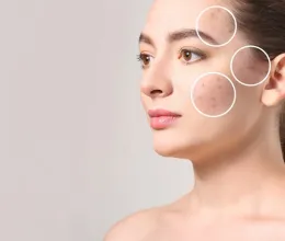 Ez a népszerű vitamin okozhatja az arcon és a háton lévő csúnya pattanásokat: az aknék valódi kiváltója lehet Ez a népszerű vitamin okozhatja az arcon és a háton lévő csúnya pattanásokat: az aknék valódi kiváltója lehet