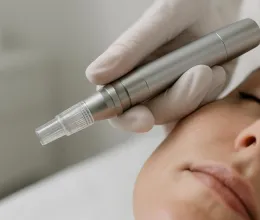 A bőrfiatalítás új útja: spikula és Liquid Microneedling