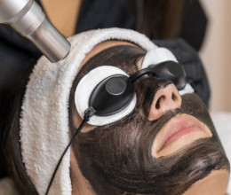 Carbon peeling: mikor érdemes választani, és mit várhatsz tőle?