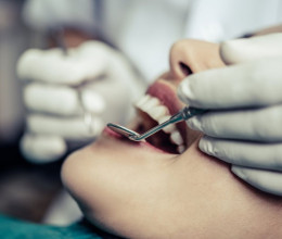 Gyökérkezelés menete: így zajlik lépésről lépésre