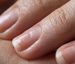 A körmöd leplezi le, hogy milyen betegséged lehet, csak meg kell tanulni leolvasni