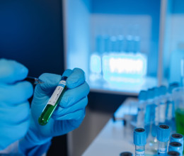 Rejtélyes pestisjárványt szabadíthattak el a kutatók Orszországban, már halálos áldozat is van Rejtélyes pestisjárványt szabadíthattak el a kutatók Orszországban, már halálos áldozat is van