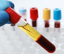 Plazmaadó adok-kapok, avagy miért jó a plazmaadás?