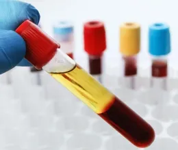 Plazmaadó adok-kapok, avagy miért jó a plazmaadás?