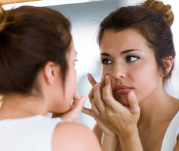 Szakértők osztották meg a sötét foltok elleni 3 legtutibb tippet - szabályosan leradírozhatod őket magadról Szakértők osztották meg a sötét foltok elleni 3 legtutibb tippet - szabályosan leradírozhatod őket magadról