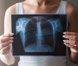 Ekkortól kezd el egyre gyengébben teljesíteni a tüdőd, de lehet rajta javítani