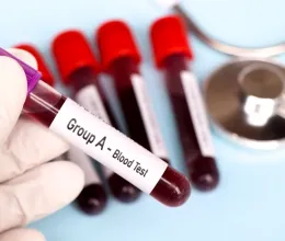 Neked is ez a vércsoportod? Akkor valószínűleg nehezebben fogysz, de akár 10 évvel is tovább élhetsz, mint mások