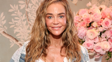 Charlie Sheen 55 éves volt felesége arcplasztikán esett át: így néz ki most Denise Richards a műtét után