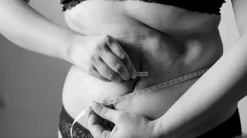 5+1 gyakori tévhit a hasplasztikáról – és az igazság, hogy körültekintően dönthessünk a műtétről